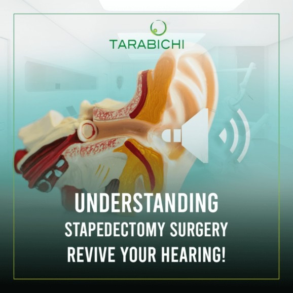 post image img-fluid