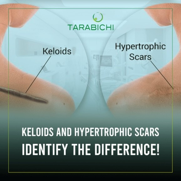 post image img-fluid